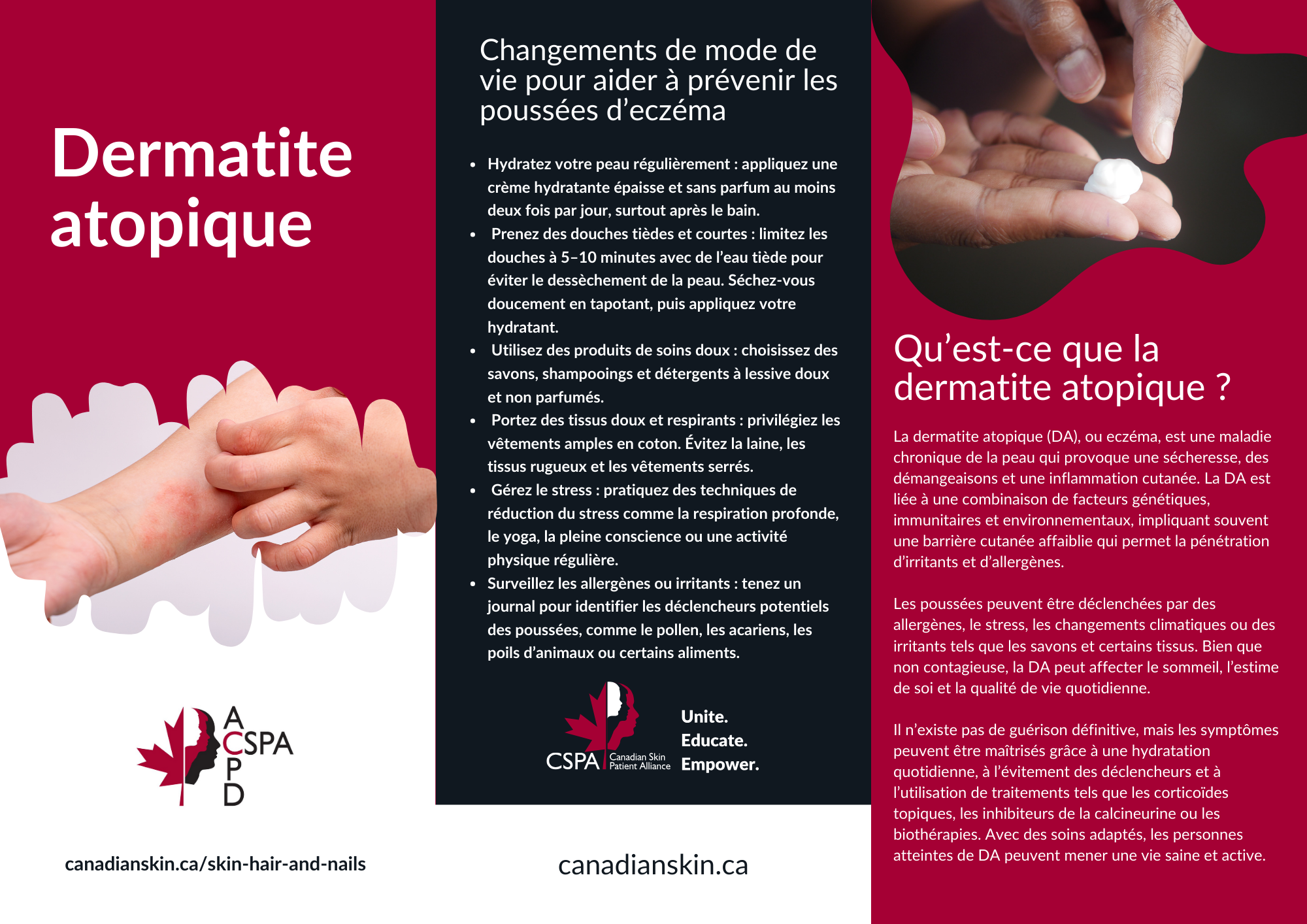 Atopic Dermatitis Brochure 2025 ENFR 1